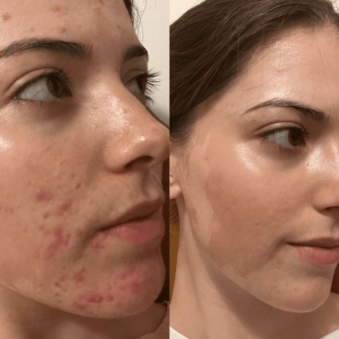 Lamixtura Special Care