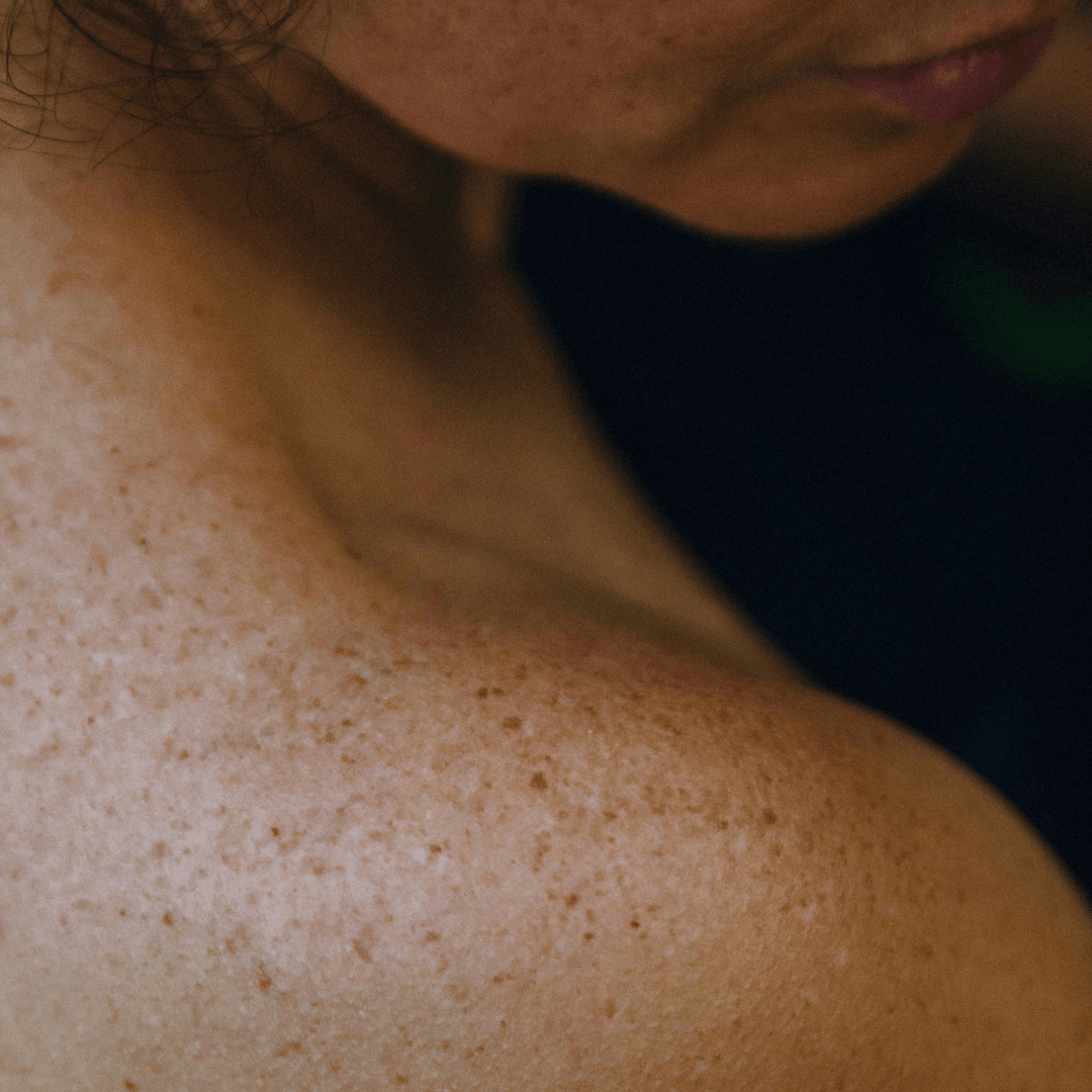 manchas melasma melanina serum iluminador