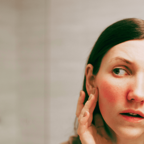 piel enrojecida retinol